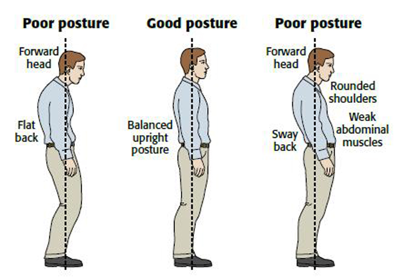 Standing-body alignment A) Lateral View-Good posture. B) Lateral View