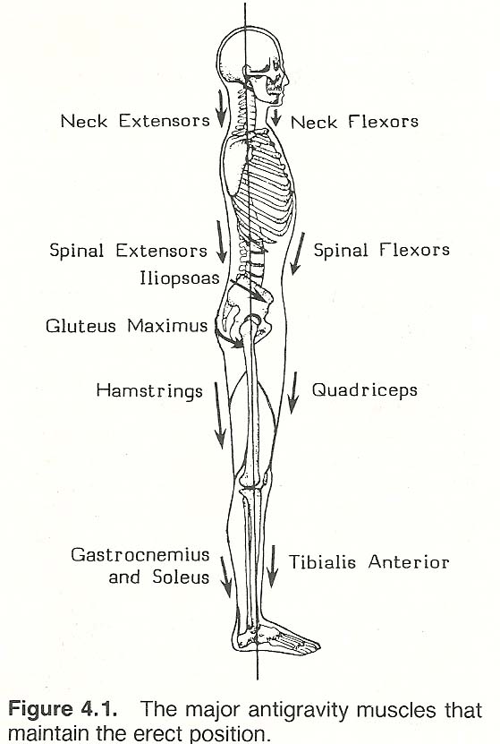 Schematic overview over different postures. A straight upright