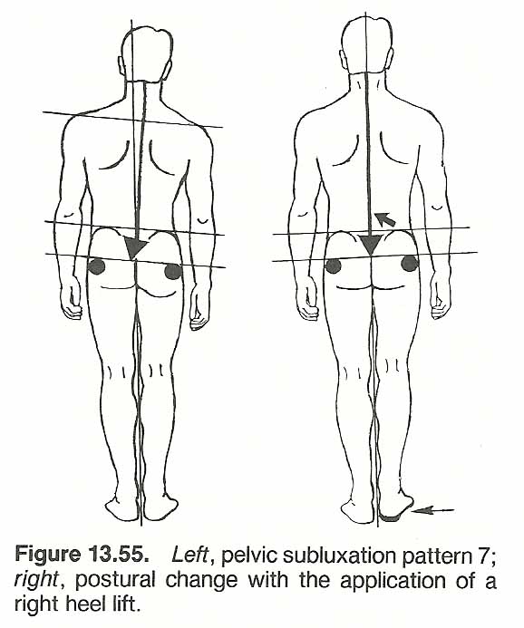 Modern Chiropractic and Wellness Center - Anatomical Plumb Line