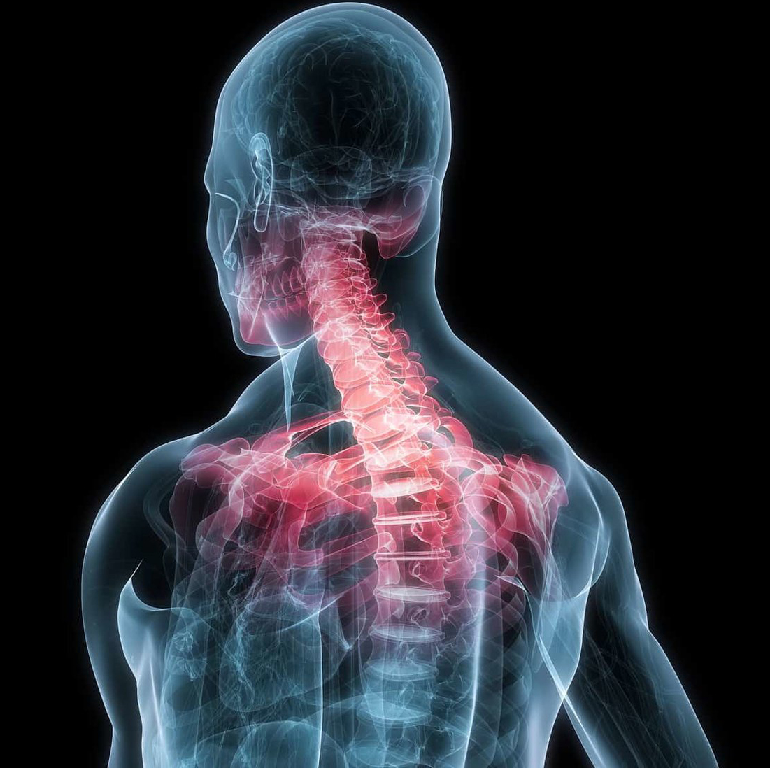 Limited Prognostic Value of Pain Duration in Non-specific Neck Pain Patients Seeking Chiropractic Care