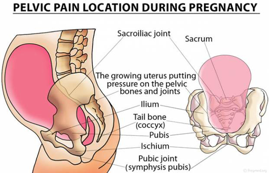 How to reduce lower back and pelvic girdle pain (PGP)