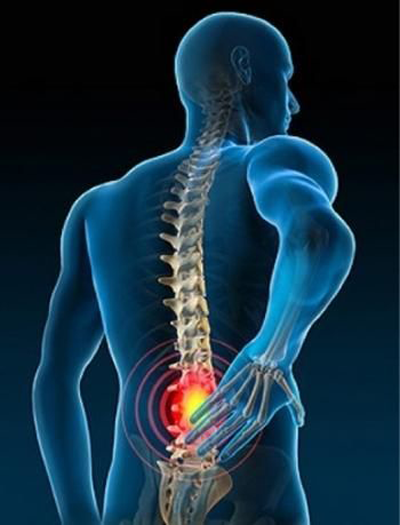  Understanding Low Back Pain Anatomical Chart