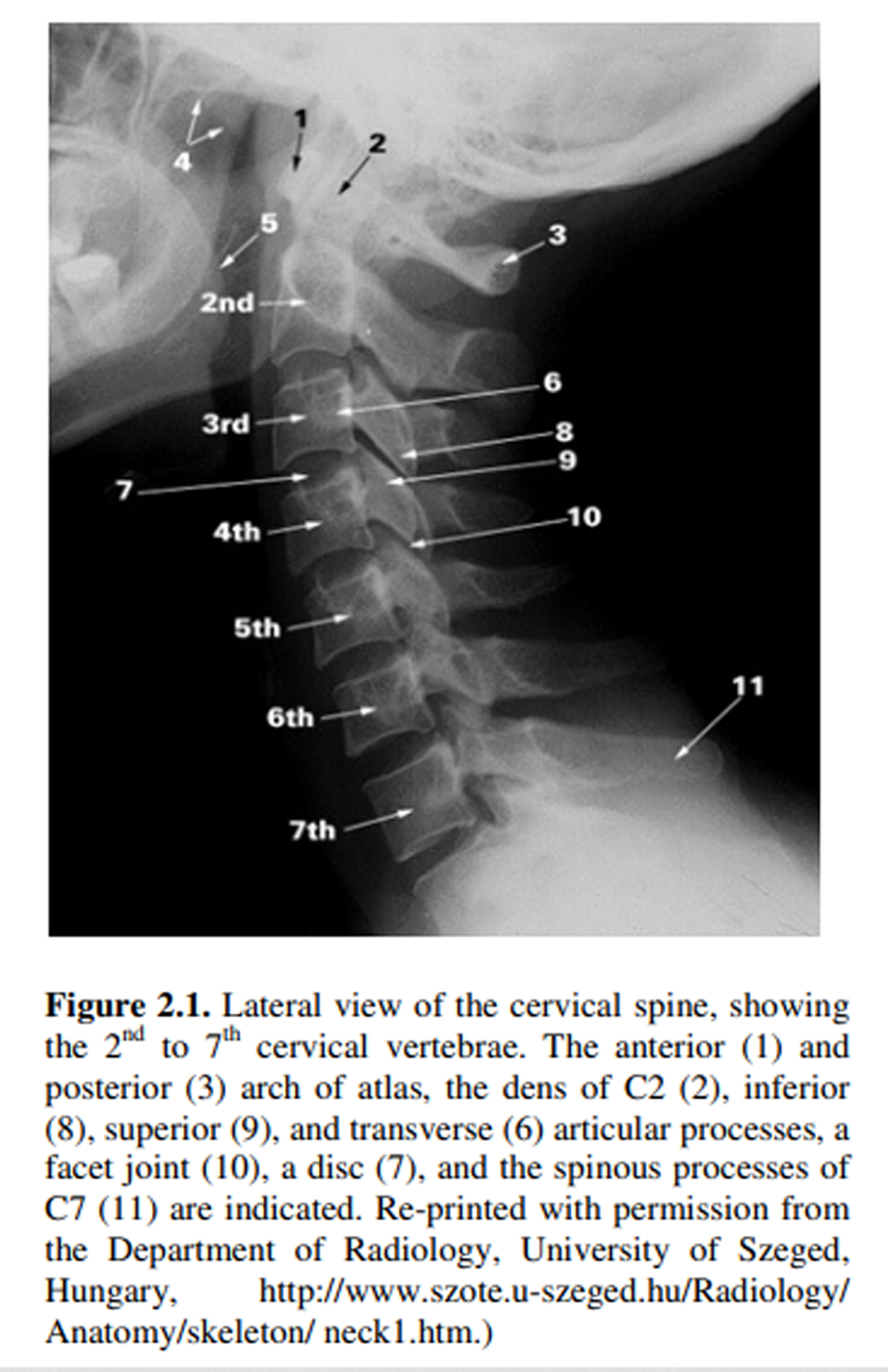 Examining Clinical Opinion and Experience Regarding Utilization of Plain Radiography of the Spine: Evidence from Surveying the Chiropractic Profession