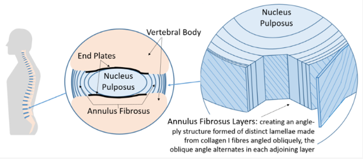 Annulus Fibrosus Spine