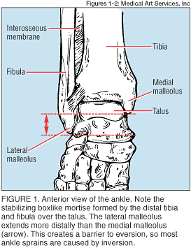 medial ankle sprain