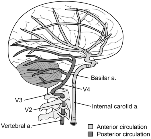 Internal carotid artery chronic occlusion: B-mode and colour